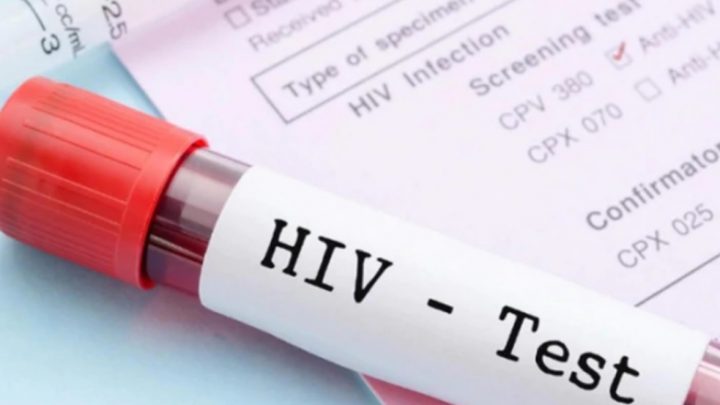 En Tierra del Fuego 3 de cada 10 personas conviven con VIH y aún no lo saben