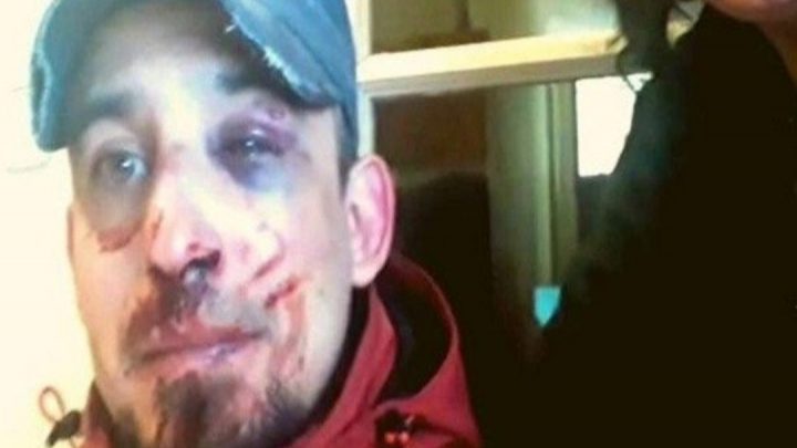 Salió A Repartir Alimentos Y Cuatro Policías Lo Golpearon Brutalmente Por No Cumplir La Cuarentena