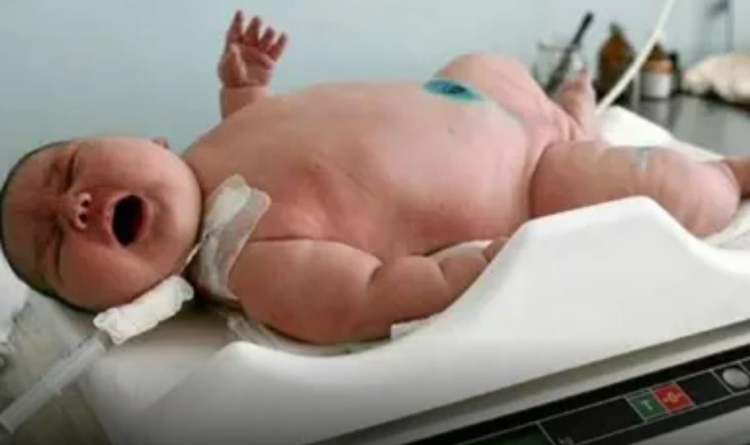 ¡Nuevo record! nació el bebé más grande del mundo en Australia ¡Pesa 18 kg! ¡Nuevo record! nació el bebé más grande del mundo en Australia ¡Pesa 18 kg!