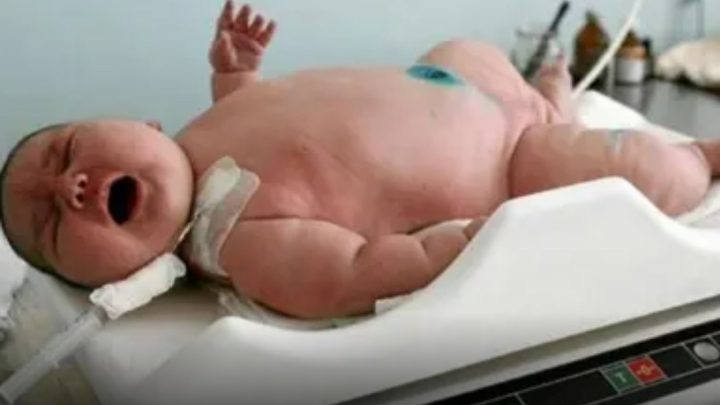 ¡Nuevo record! nació el bebé más grande del mundo en Australia ¡Pesa 18 kg!