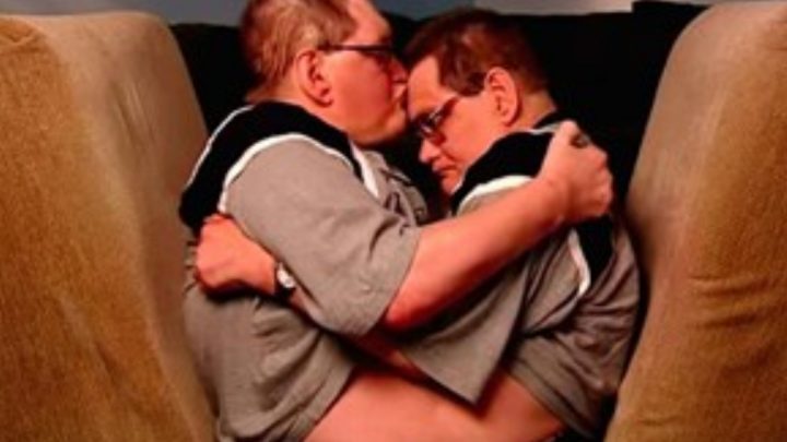 Murieron los hermanos siameses más longevos del mundo: vivieron 68 años con sus cuerpos unidos