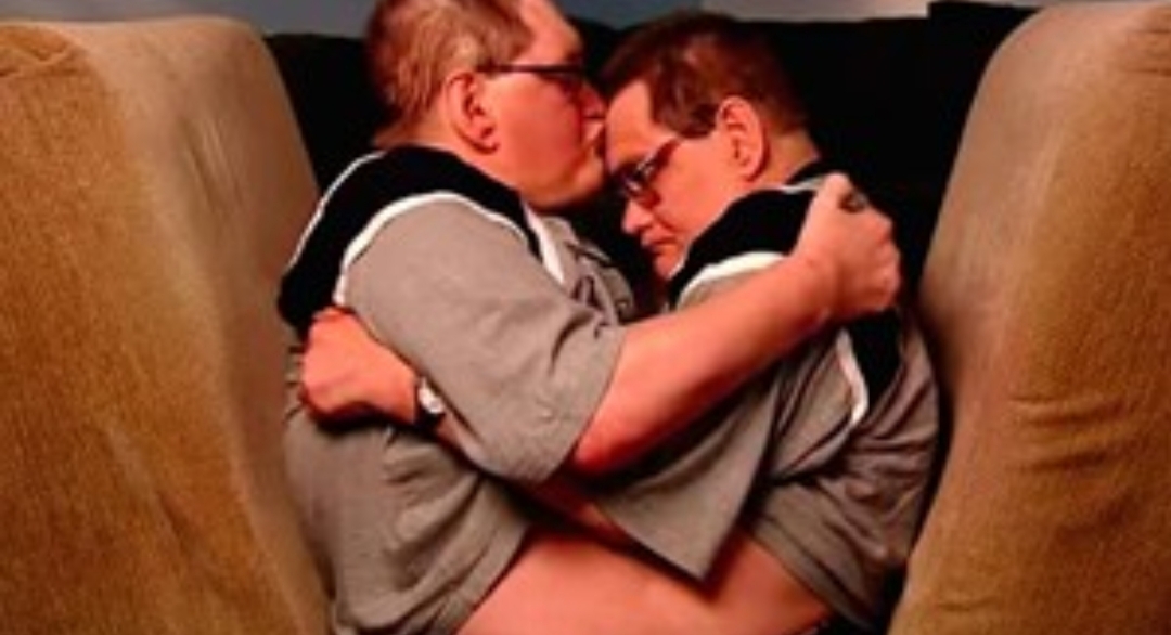 Murieron los hermanos siameses más longevos del mundo: vivieron 68 años con sus cuerpos unidos