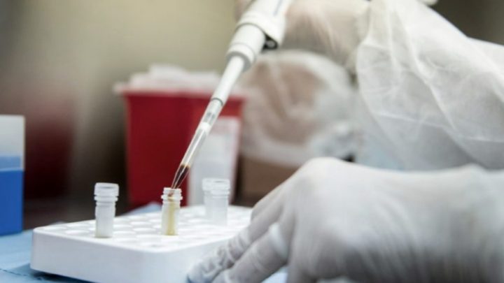 Argentina fue elegida para probar una vacuna contra el coronavirus