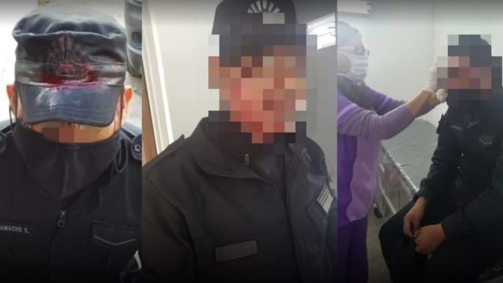 Le hundieron el cráneo a un policía por pedir que paren de jugar al fútbol