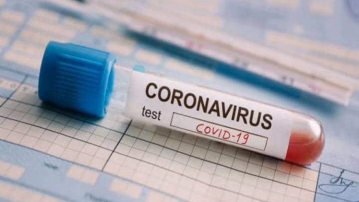 Coronavirus habra aumento significativo de casos en los próximos partes
