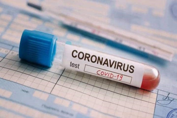 Coronavirus habra aumento significativo de casos en los próximos partes