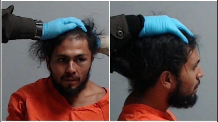 Policías lo golpearon y quedó parapléjico: tuvieron que sostenerle la cabeza para la foto