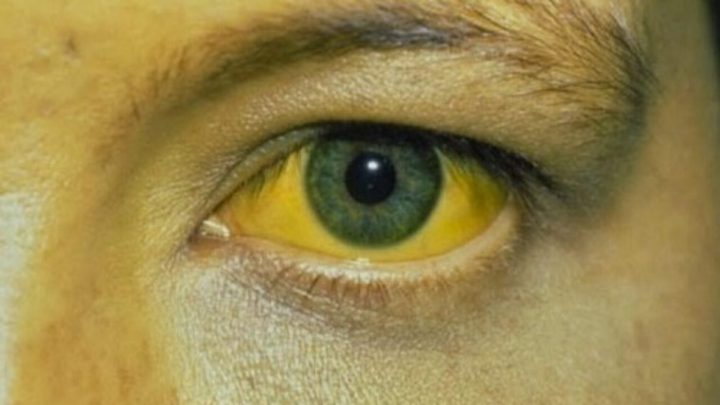 Usó una mascarilla facial y terminó con la cara amarilla por 2 días