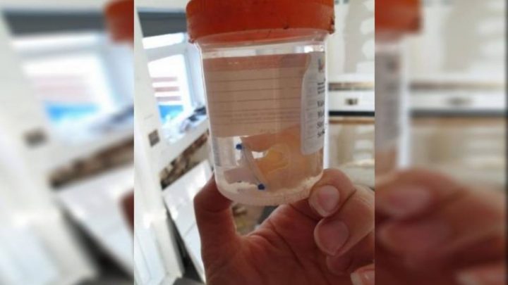 Se mudó y en su nueva casa encontró un órgano en un frasco