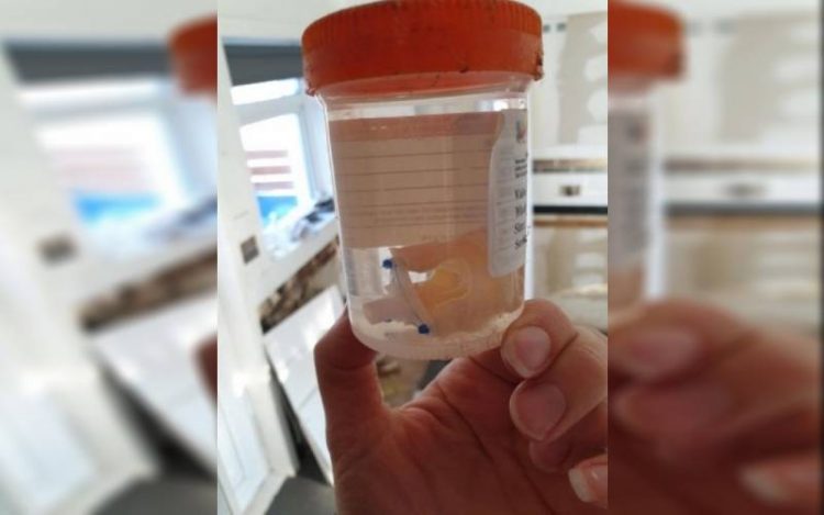 Se mudó y en su nueva casa encontró un órgano en un frasco
