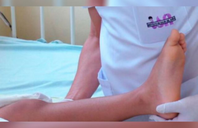 Le implantaron un injerto de hueso de un cadáver y salvaron la pierna de un nene de 8 años Le implantaron un injerto de hueso de un cadáver y salvaron la pierna de un nene de 8 años