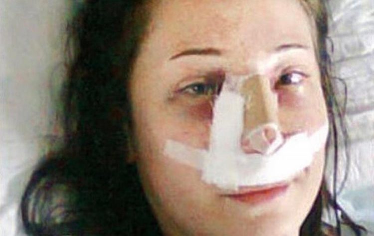 Fue a un hospital a operarse la nariz y le amputaron las dos piernas por un error Fue a un hospital a operarse la nariz y le amputaron las dos piernas por un error