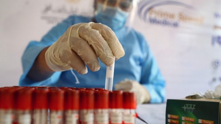 Covid-19: un estudio argentino demuestra que 95% de pacientes desarrolló anticuerpos a los 45 días