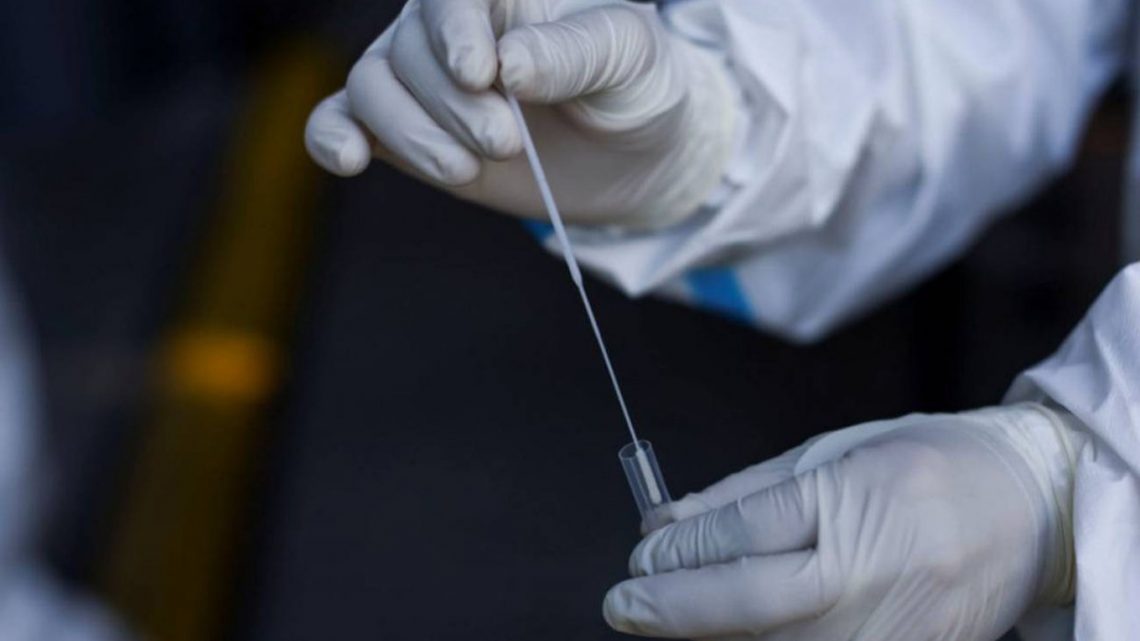 Un asesor del Gobierno elogió los hisopados anales para detectar el coronavirus: “Es más eficaz” Un asesor del Gobierno elogió los hisopados anales para detectar el coronavirus: “Es más eficaz”