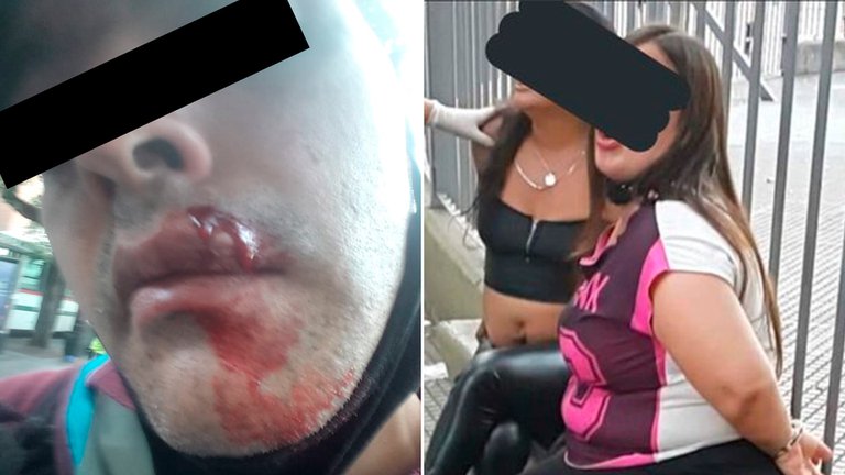 Un policía les pidió a dos mujeres que se pusieran el barbijo: lo atacaron a piedrazos y lo enviaron al hospital