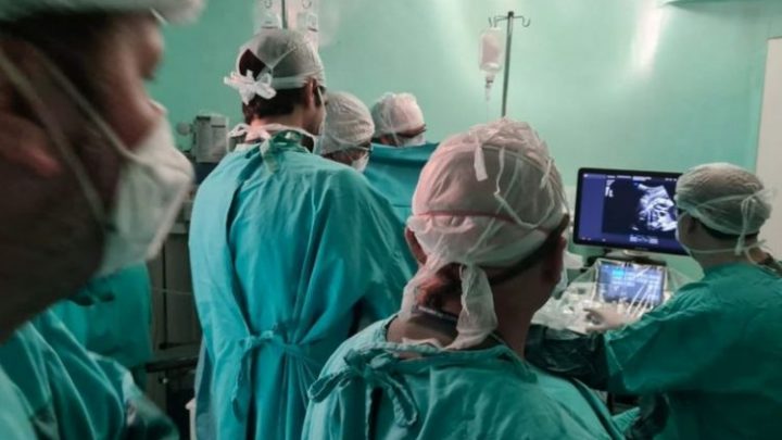 Operaron a un bebé de 32 semanas de gestación en el vientre de su mamá