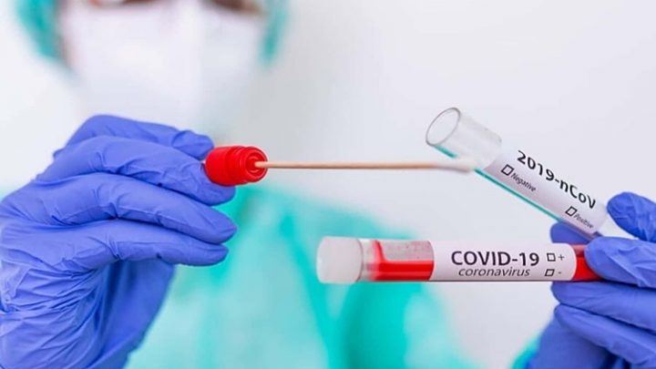 TDF mas de 19 mil casos y 281 muertos en la provincia en 2020