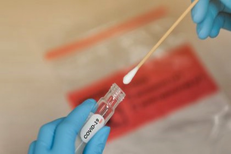 Desde Febrero sin parte diario de casos de Coronavirus Desde Febrero sin parte diario de casos de Coronavirus