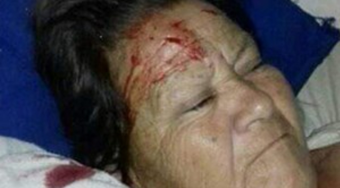 Estaba internada en un hospital y le cayó un ventilador de techo en la cara