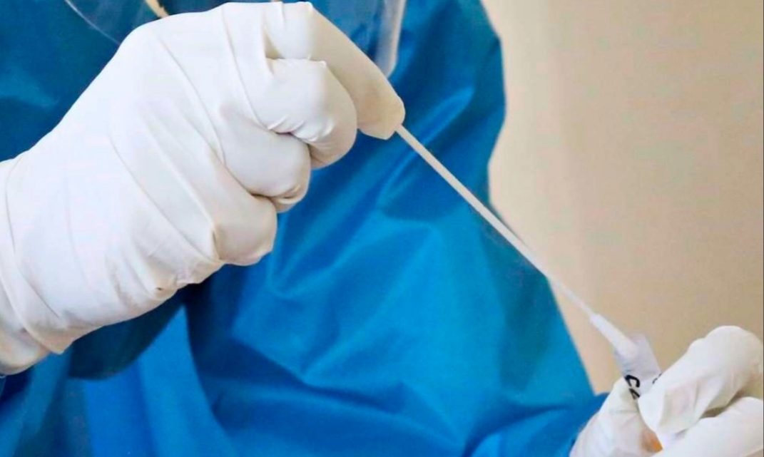 Japón le pidió a China que no haga más test anales de coronavirus Japón le pidió a China que no haga más test anales de coronavirus