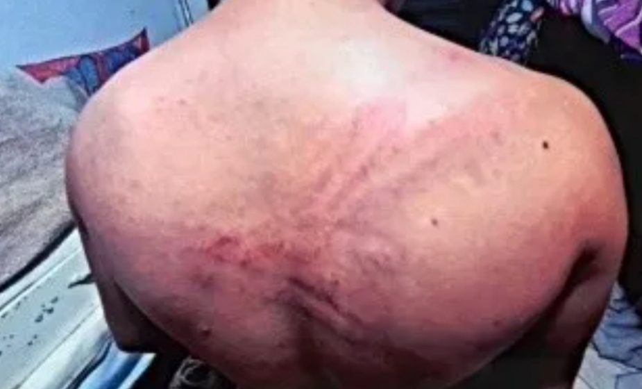 Lo torturaron porque no usaba barbijo y lo golpearon hasta hacerlo llorar: «Reíte chango o te hacemos c…» Lo torturaron porque no usaba barbijo y lo golpearon hasta hacerlo llorar: «Reíte chango o te hacemos c…»