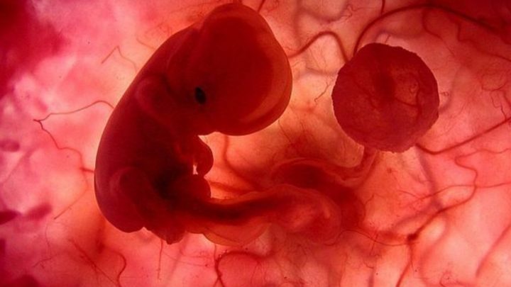 Aborto legal: Una jueza declaró inconstitucional la IVE