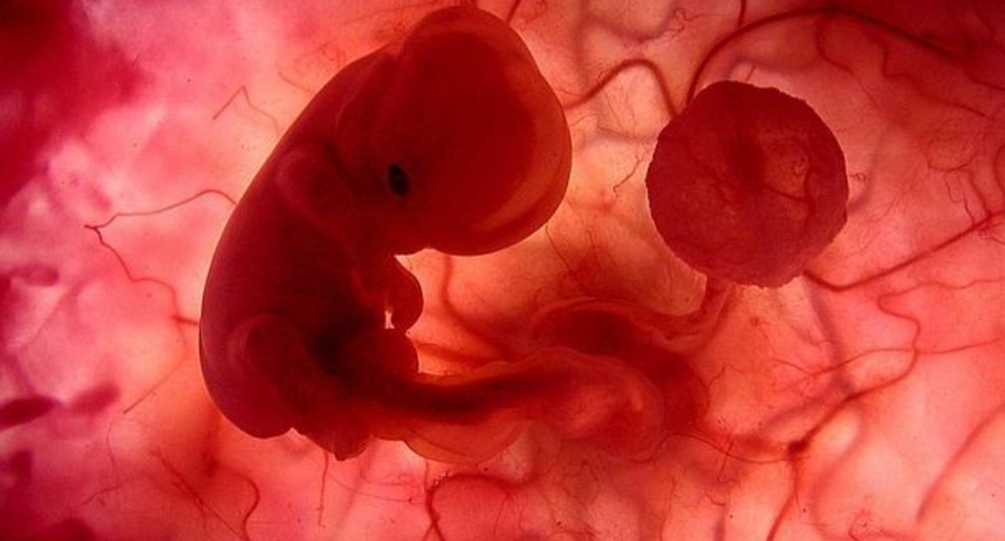 Aborto legal: Una jueza declaró inconstitucional la IVE Aborto legal: Una jueza declaró inconstitucional la IVE