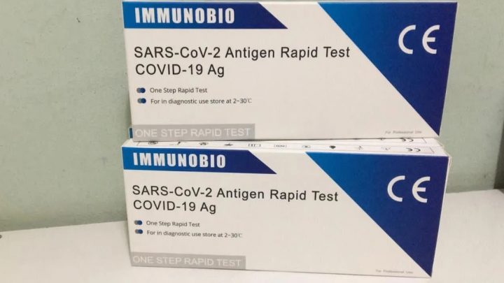Test rápido de antígeno: se vende en farmacias y detecta el coronavirus en 10 minutos