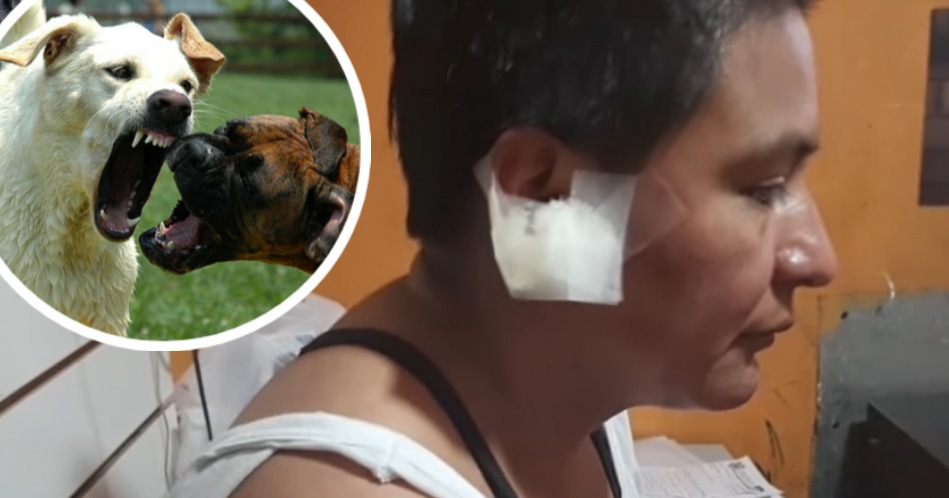 Terrible: Una mujer perdió parte de su oreja al ser atacada por al menos 10 perros