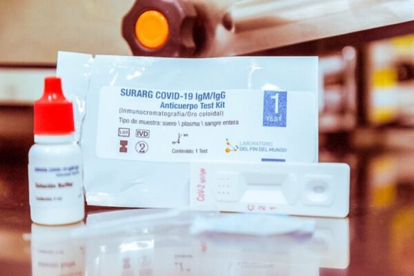 Comercialización de test rápidos: “Para el Laboratorio es un orgullo”, sostuvo Andina Silva