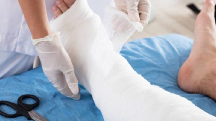 Le amputaron la pierna equivocada tras confundirse durante la cirugía