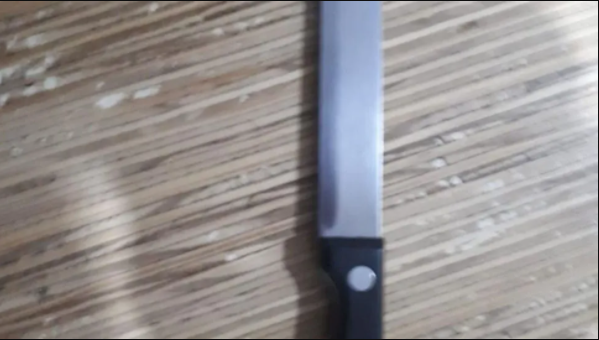 Atacó a su pareja con un cuchillo: le lastimó un ojo y la cara Atacó a su pareja con un cuchillo: le lastimó un ojo y la cara