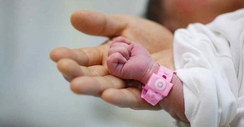 Un bebé nació con su hermano gemelo en el estómago: tenía corazón, cerebro y huesos