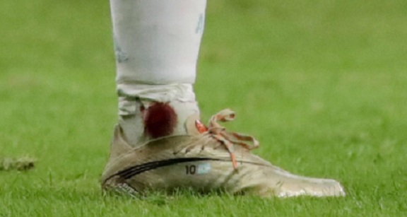 El tobillo de Messi, la gran preocupación para la final de la Copa América: cómo es su estado