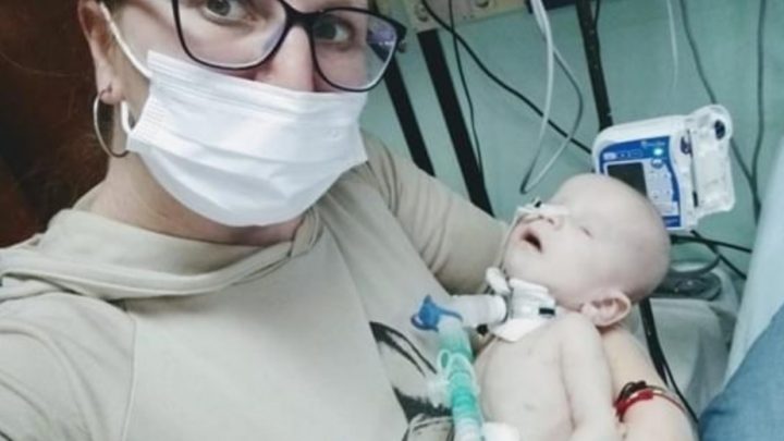 Beba De Bahía Blanca Necesita Viajar Al Garrahan: «No Tiene Ojos Y Su Cerebro No Se Desarrolla»