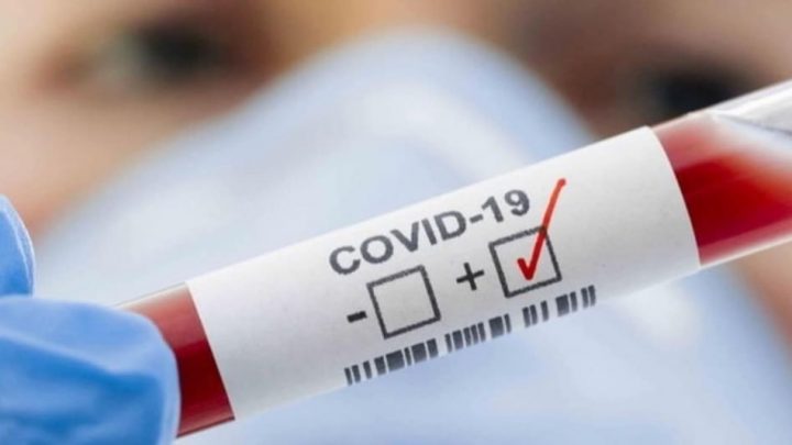 Se Registraron 5.889 Nuevos Contagios De Coronavirus En El País