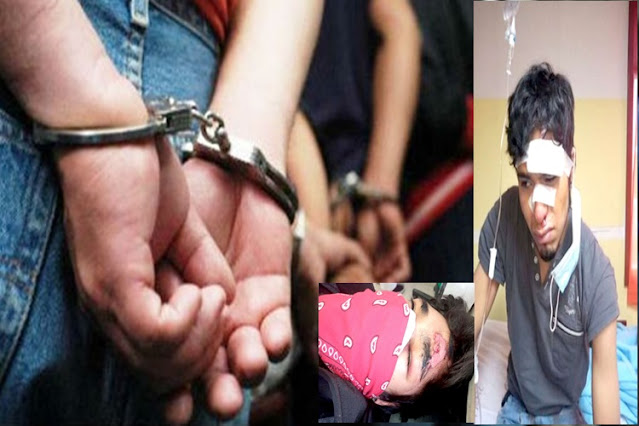 Denuncian a policías por una golpiza a jóvenes, pero para el Comisario, fue un mano a mano