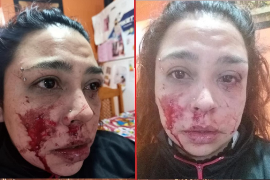 Indignante: Hizo 10 denuncias y no obtuvo soluciones. Ayer su ex pareja le dio una brutal paliza Indignante: Hizo 10 denuncias y no obtuvo soluciones. Ayer su ex pareja le dio una brutal paliza