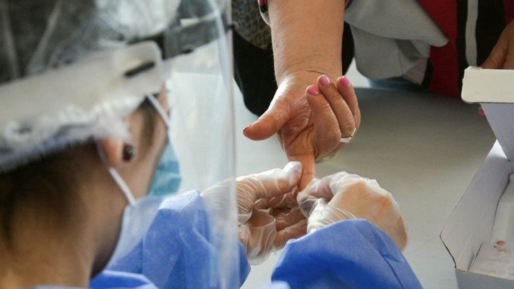 La Anmat aprobó un test rápido que detecta anticuerpos en la fase temprana del virus