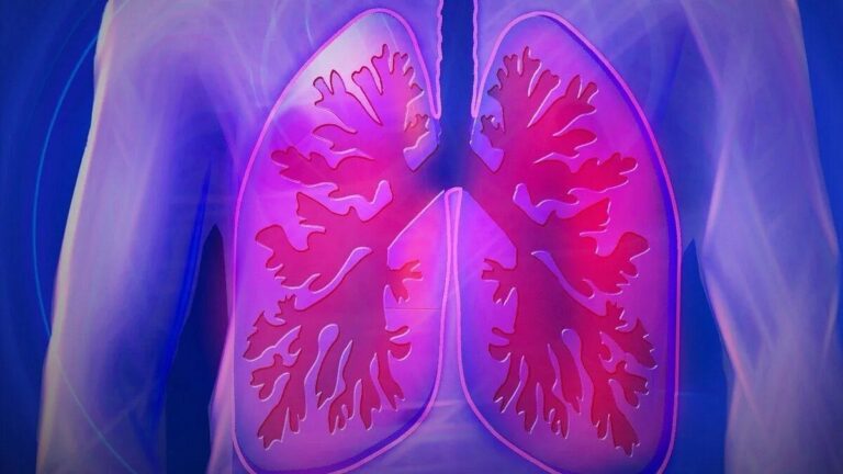 Cáncer de Pulmón: la importancia del diagnóstico a tiempo