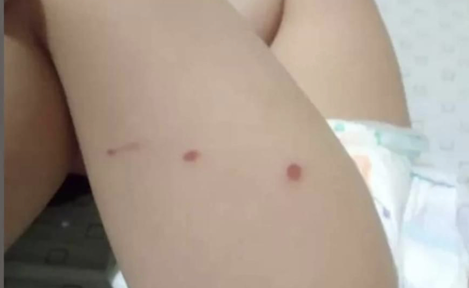 Otro caso Lucio en La Pampa? Un padre denunció que a su hija la queman con cigarrillos