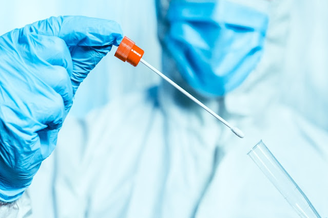 Escasez de test, nuevo criterio de Salud para confirmar caso positivo sin testeos