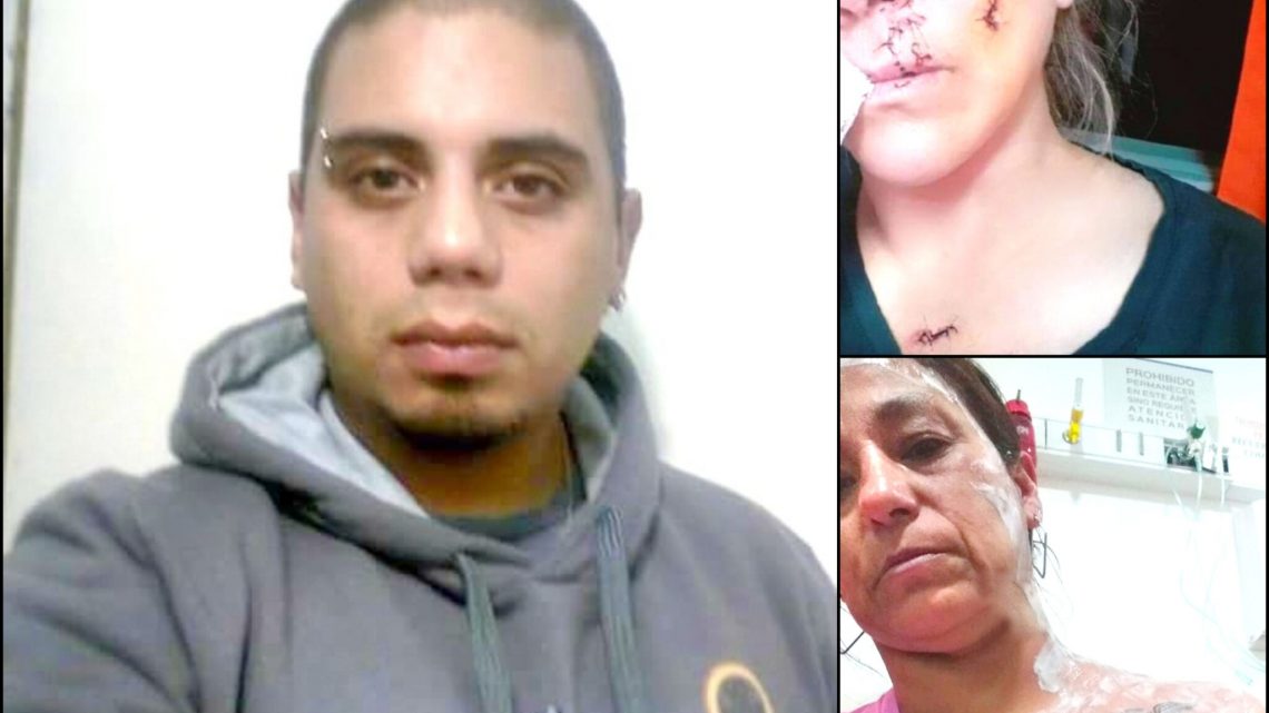 Se negó a declarar el sujeto que agredió a dos mujeres con agua hirviendo y un vaso roto Se negó a declarar el sujeto que agredió a dos mujeres con agua hirviendo y un vaso roto