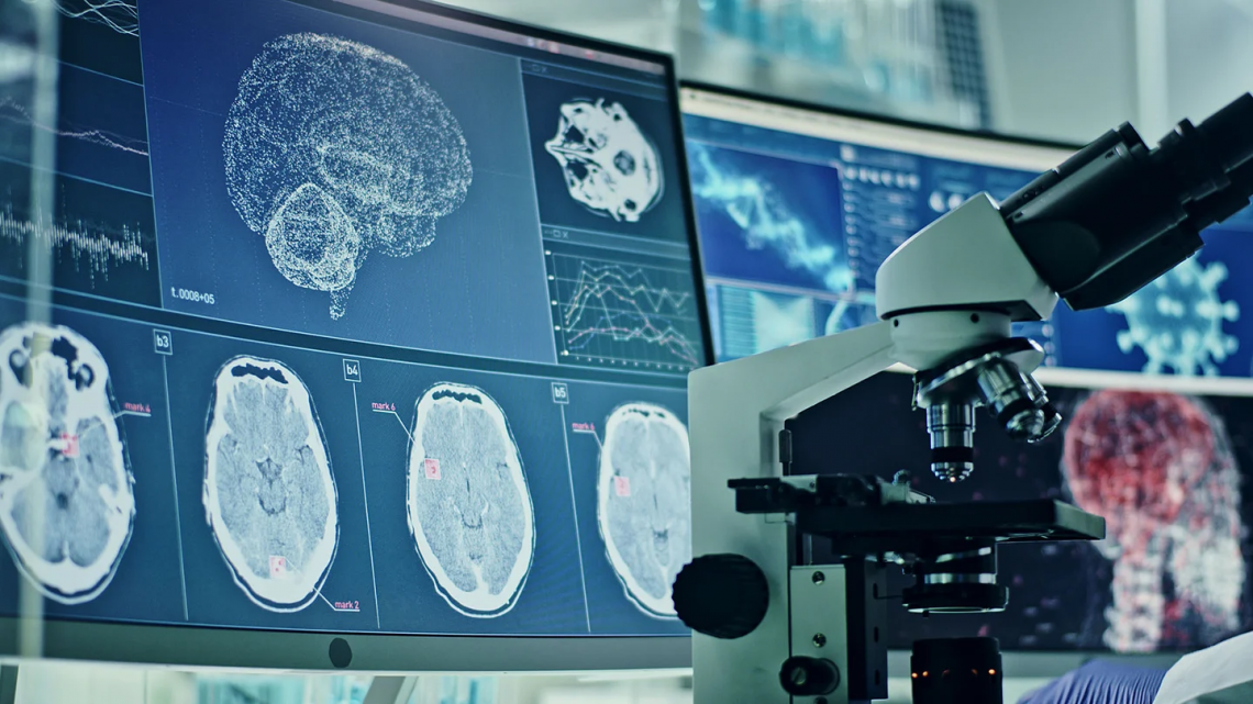 El cerebro de las mujeres: 1 de cada 6 tiene riesgo de ACV a partir de los 60 años