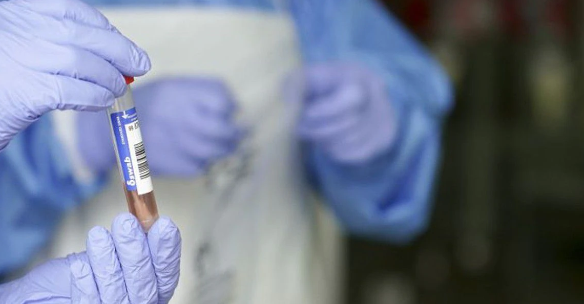 Alerta en la OMS por la variante XE, la nueva cepa del coronavirus descubierta en Reino Unido
