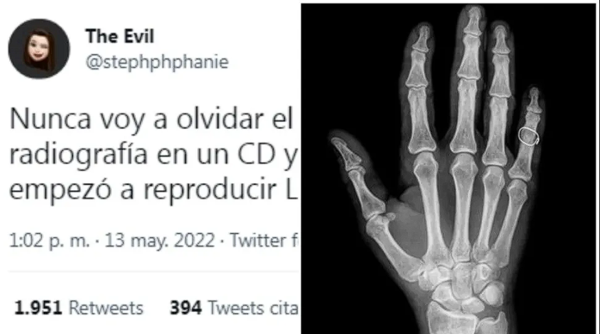 Viral: tenía que llevar sus radiografías en un CD, pero se equivocó de disco y pasó la vergüenza de su vida