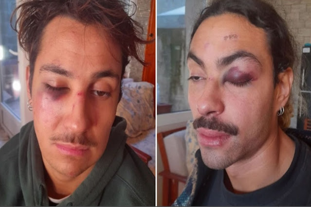 Denuncian inacción policial a la salida de un boliche