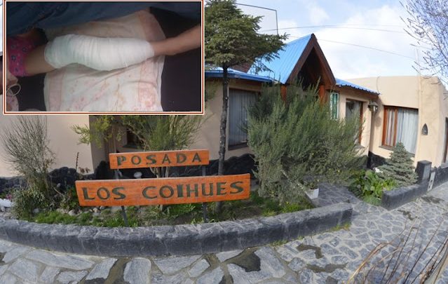 Menor sufrió graves heridas al ser mordida por perros dentro una posada en Ushuaia