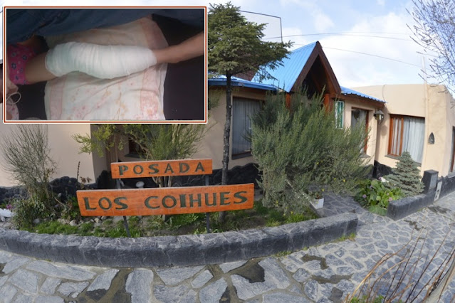 Menor sufrió graves heridas al ser mordida por perros dentro una posada en Ushuaia