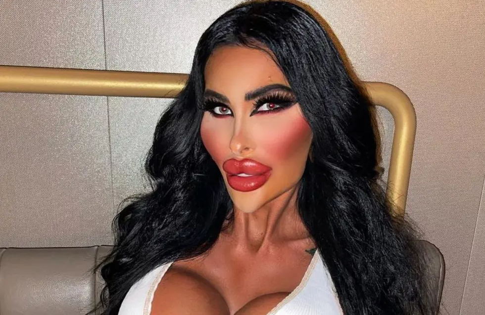 Gastó millones de dólares para parecerse a Barbie y el resultado sorprendió en las redes Gastó millones de dólares para parecerse a Barbie y el resultado sorprendió en las redes